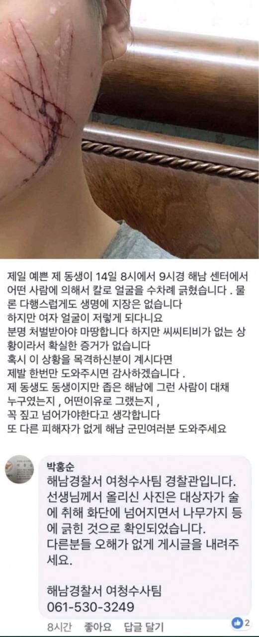 해외토픽까지 갔던 여자얼굴 난도질 사건