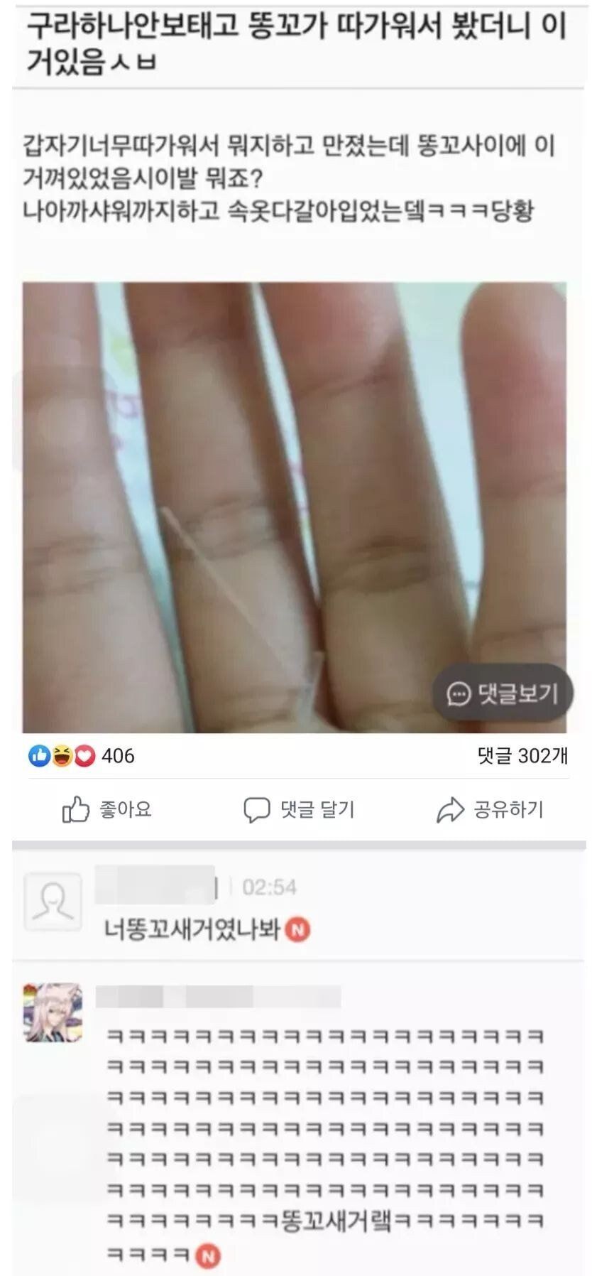 똥꼬가 따가워서 봤더니