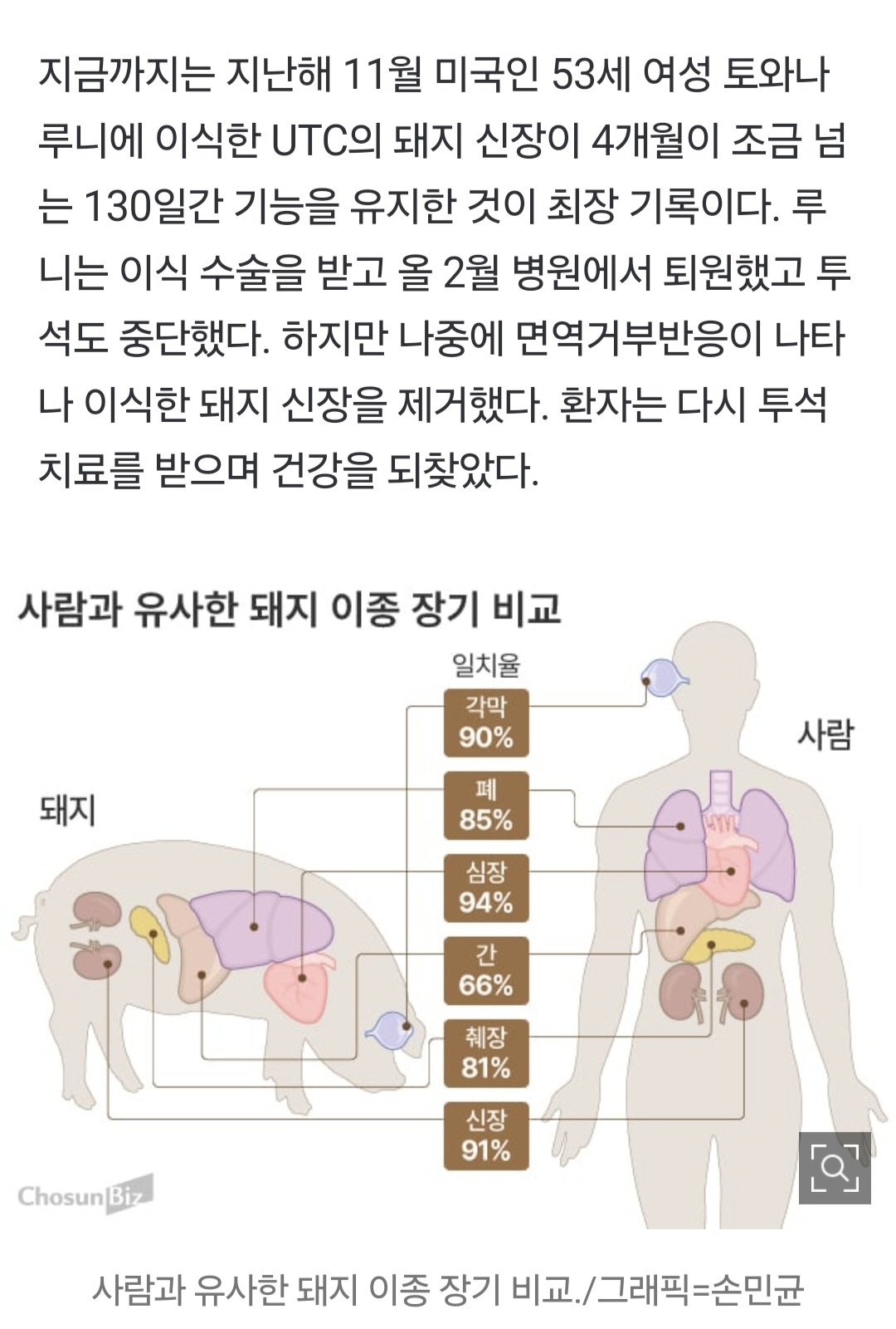 돼지 신장으로 생명 연장   한국도 내년 첫 임상시험 도전