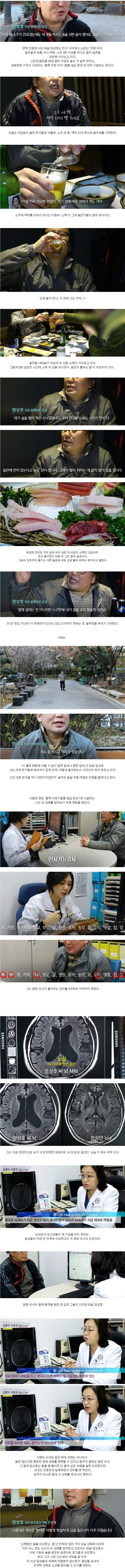 50대 애주가의 뇌상태