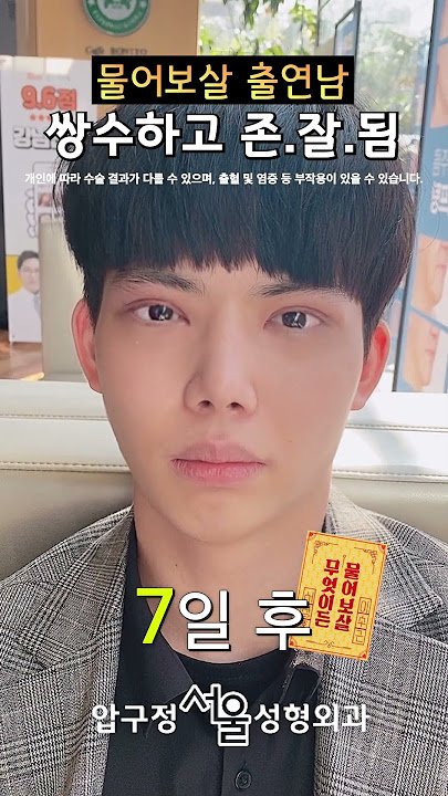 최근 눈이 작아 고민이라고 물어보살 나왔던 사람 근황ㄷㄷㄷ
