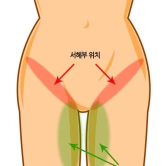 두산 양의지 부상 서혜부 위치