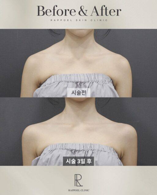 한국에서 떠오르는 뷰티 트렌드 제니 어깨