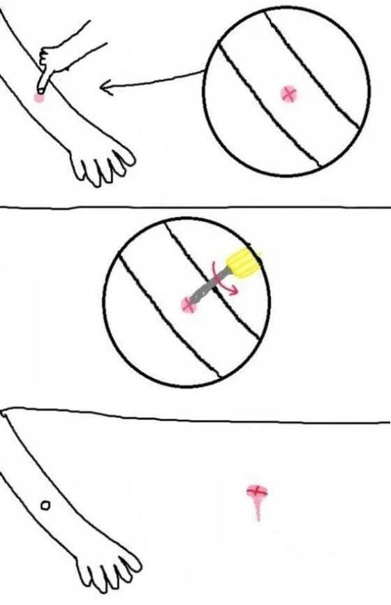 모기 물렸을 때 꿀팁