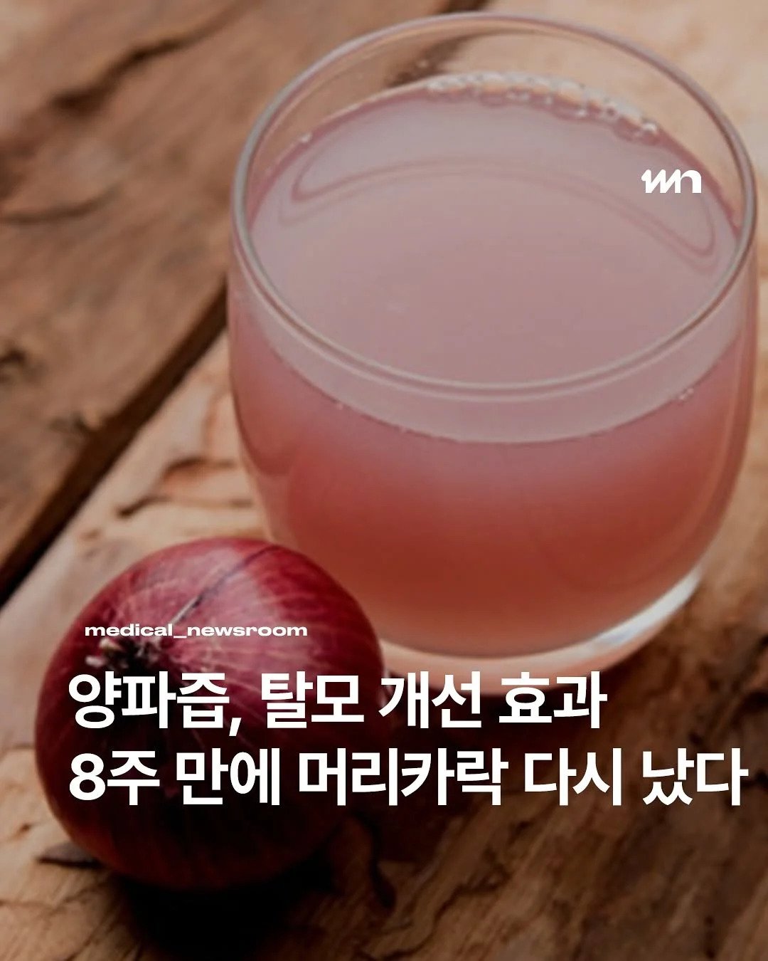 양파즙의 효능 탈모에 탁월