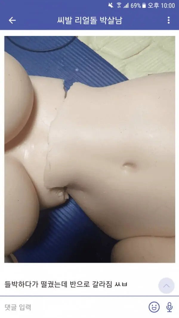 여친 들박하다가 허리 아작냈다