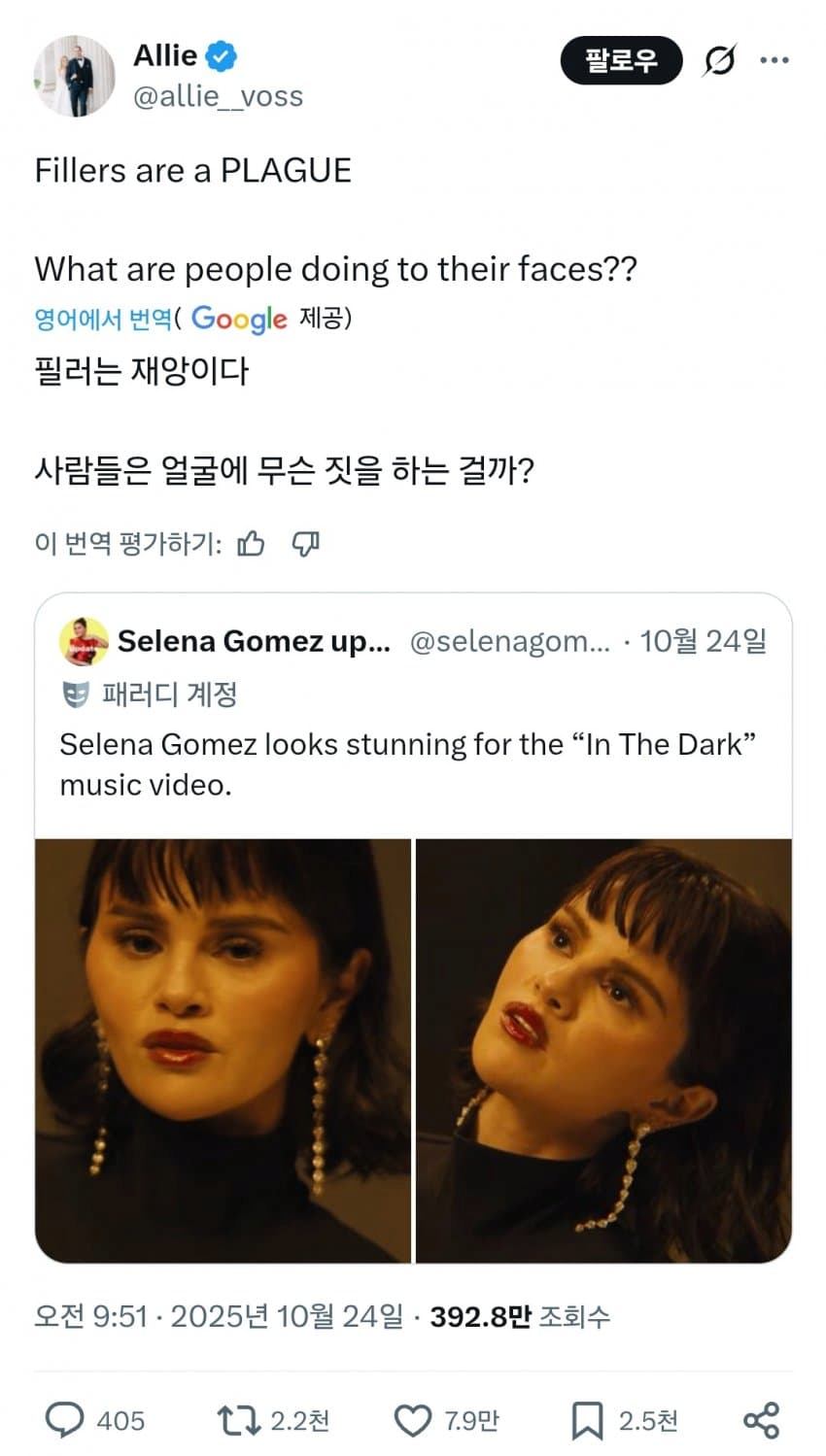 셀레나 고메즈 충격 근황