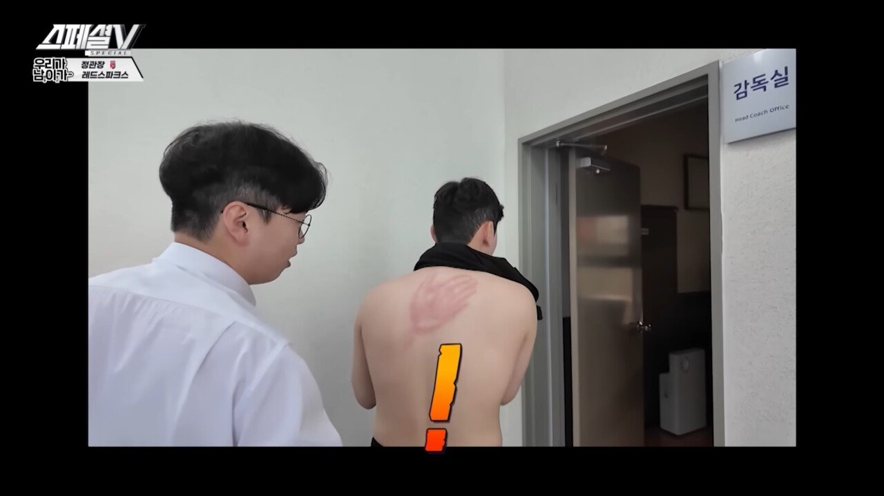여자배구선수에게 등짝 스매시를 맞으면?