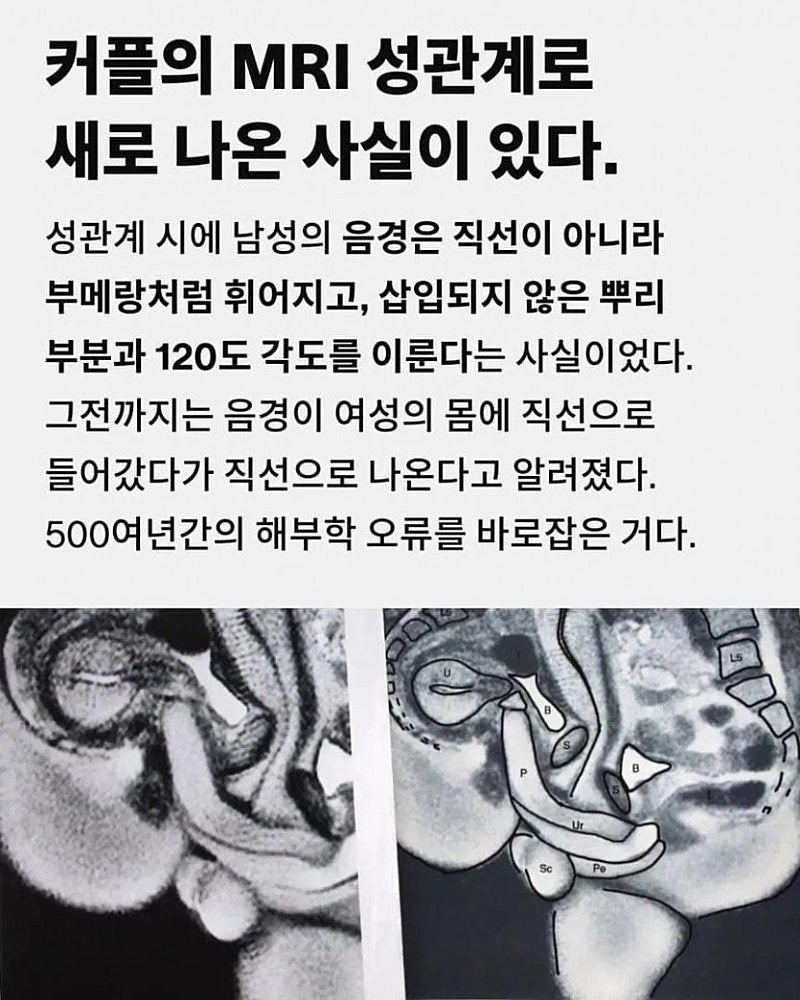 연구를 위해 MRI에서 야스한 커플