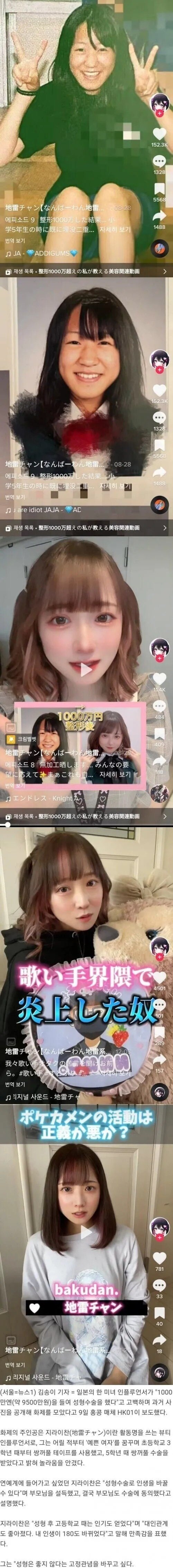 성형에 1억쓴 일본녀 ㄷㄷㄷ