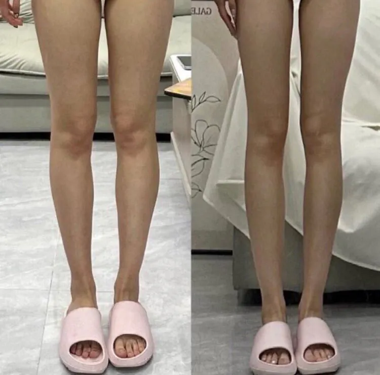 남자는 왼쪽 여자는 오른쪽 선택한다는 다리모양