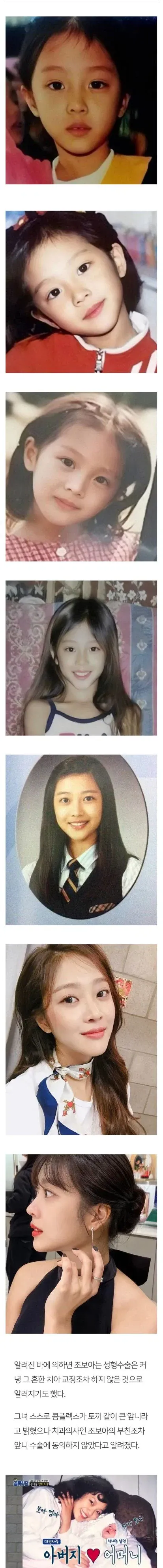 아빠가 절대 성형 못하게 했다는 배우
