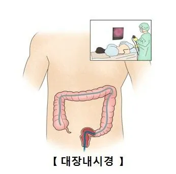 인생 쪽팔린기억 부동의 1위