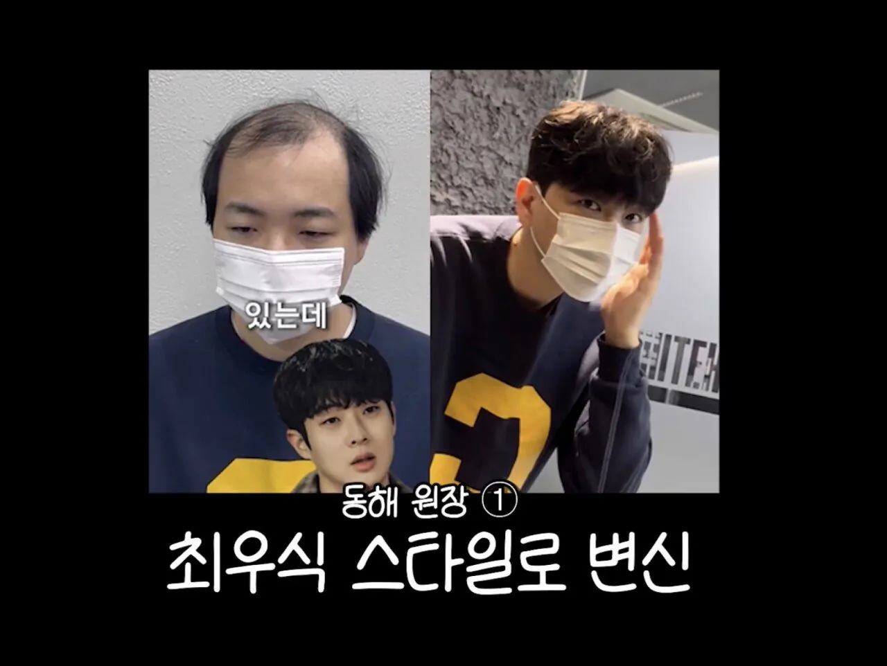 남자 머리의 중요성