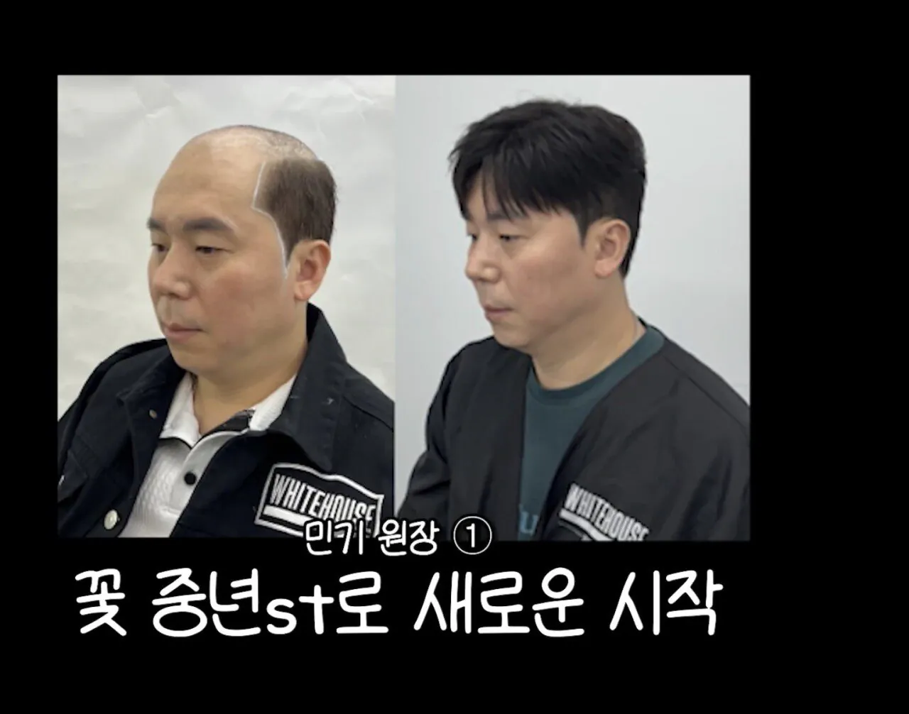 남자 머리의 중요성