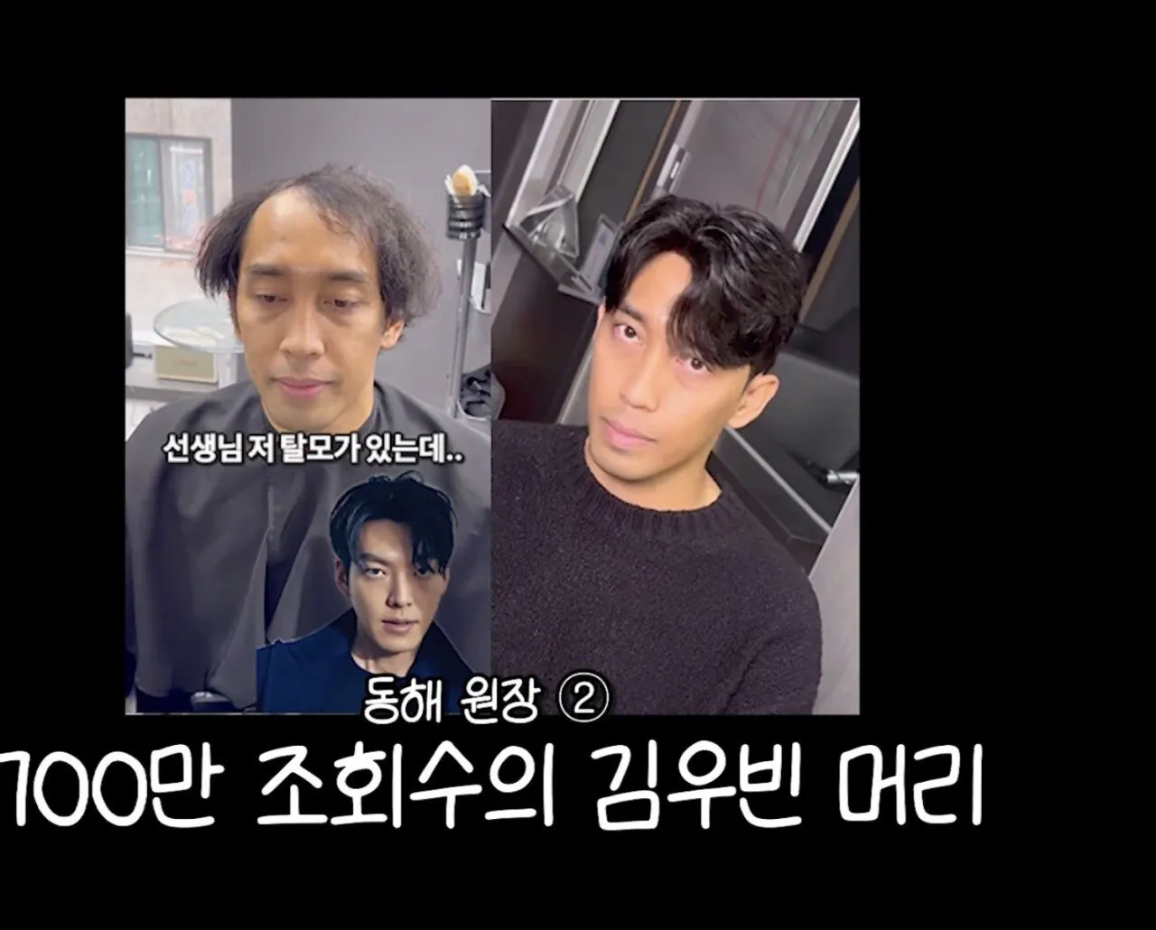 남자 머리의 중요성