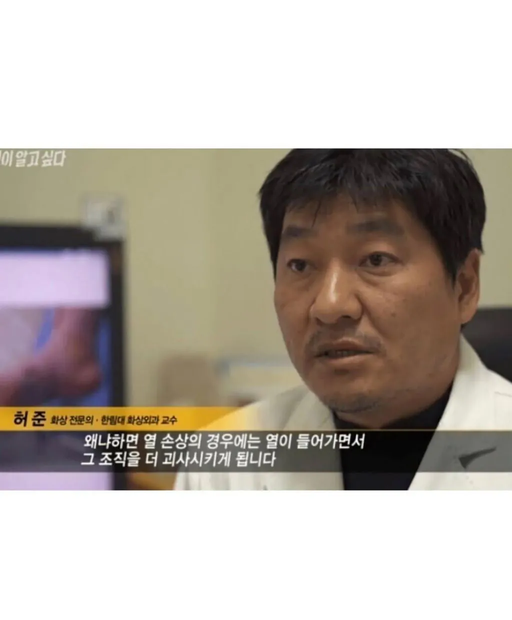 레전드급 레어 이름 소유자들